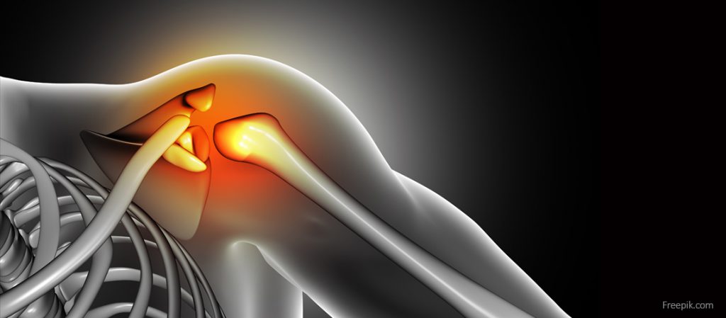Artrita si durerile articulare - cauze, simptome, remedii si preventie | afcbm.fr