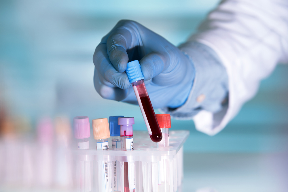 helicobacter2