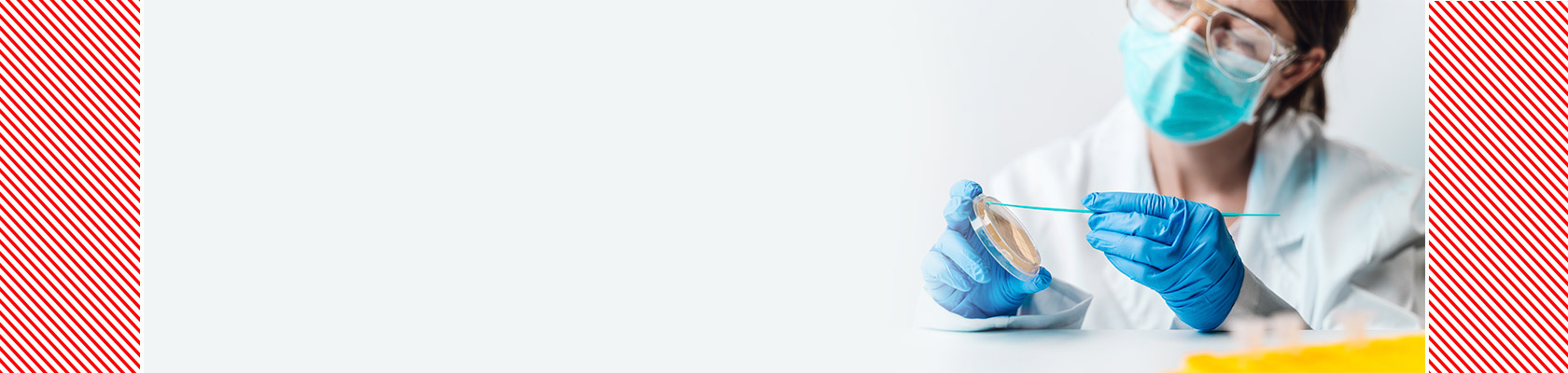 Probe microbiologice