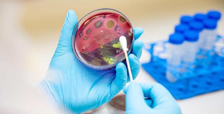 Infectia cu stafilococ auriu : Simptome, diagnostic, tratament | Blog