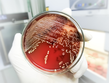 Bacteria Staphylococcus aureus