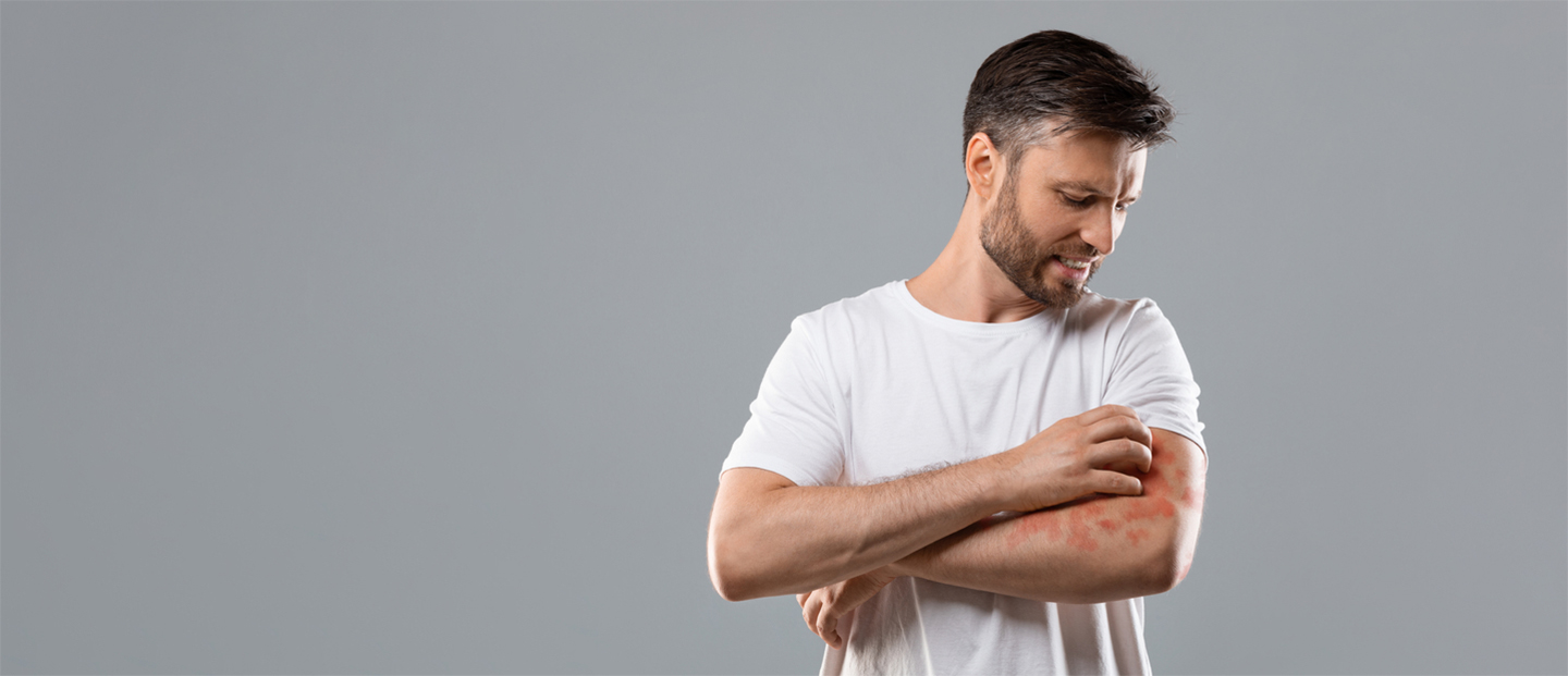 Psoriazis: cauze, simptome, tratament