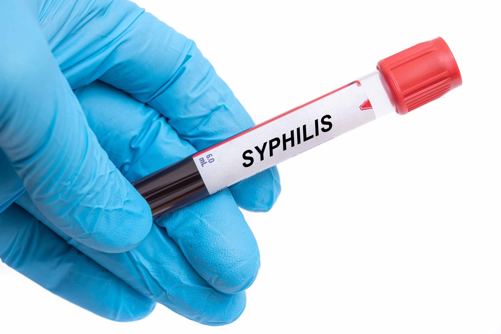 sifilis1