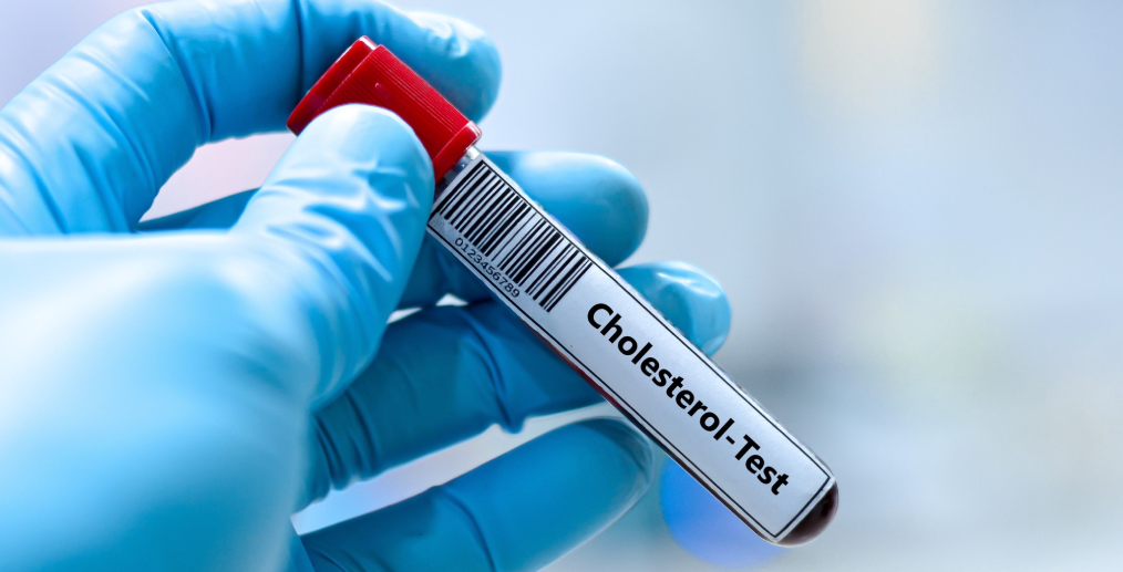 Analiză colesterol