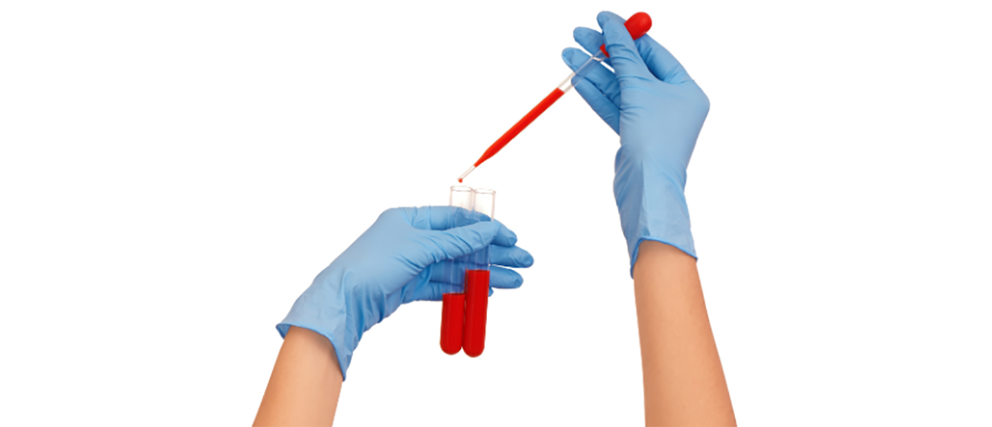 Analize utile pentru evaluarea riscurilor de boli cardiovasculare