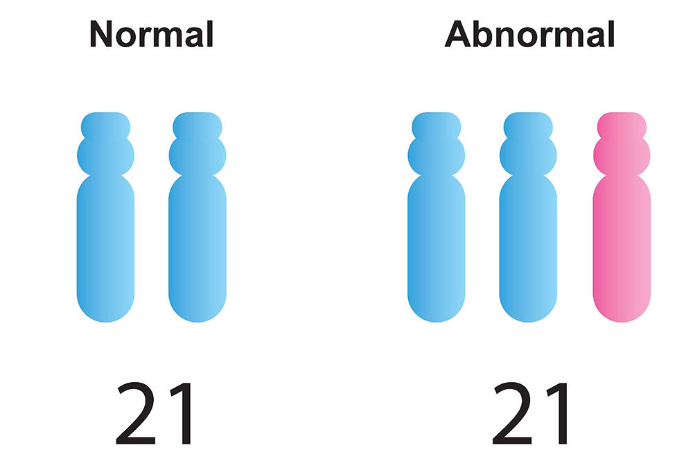 trisomnia1