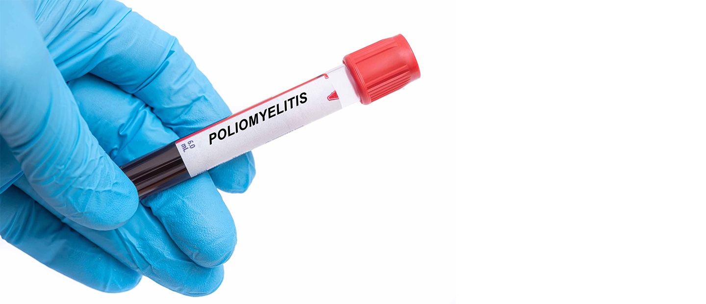 Ce este poliomielita