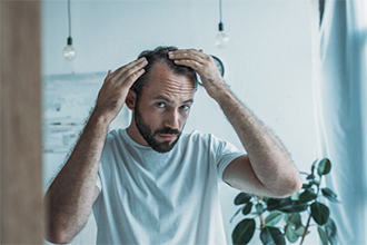alopecia-preview