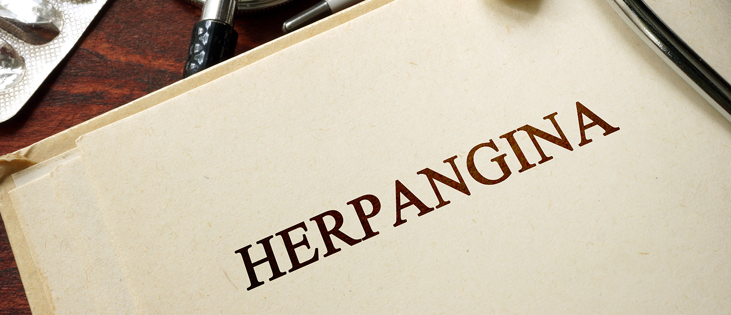 Herpangina – simptome, cauze si tratament la copii si adulti