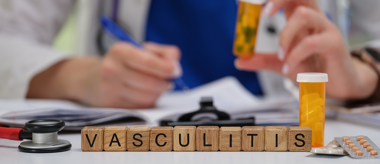 Vasculita: ce este, cum se recunoaște și ce tratamente sunt eficiente