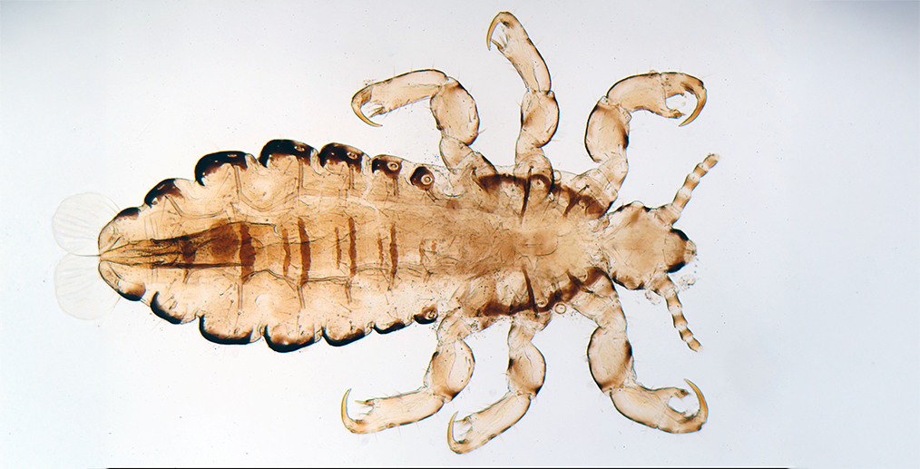 Imagine cu un paduche la microscop