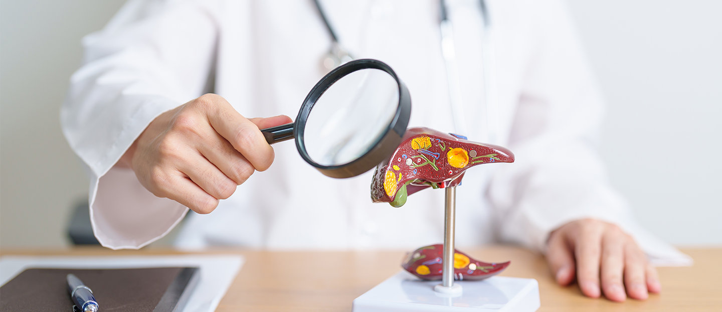 Hepatita A: simptome, cauze, diagnostic și prevenție