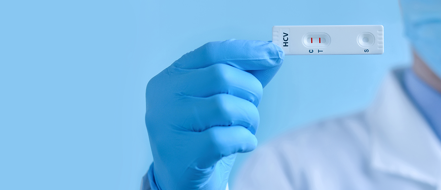 Hepatita C: simptome, cauze, prevenție și diagnostic