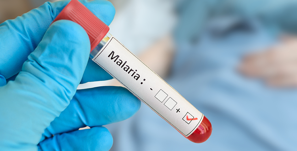 Diagnostic malarie