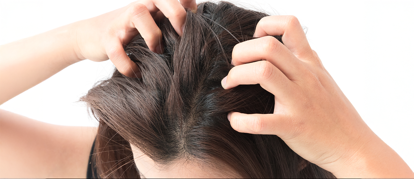 Păduchi (pediculoză): cauze, simptome, transmitere și tratament eficient