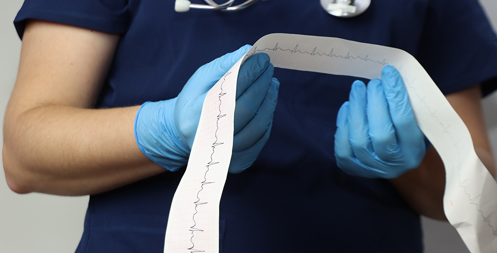 Electrocardiogramă (EKG/ECG)