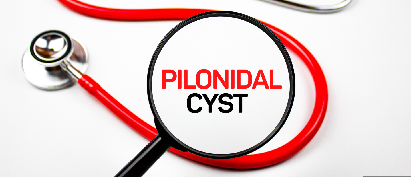 Chist pilonidal: ce trebuie să știi despre boala pilonidală și cum previi abcesul pilonidal