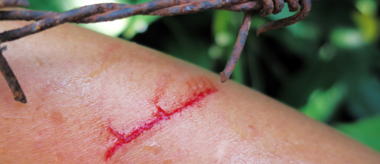 Totul despre tetanos: de ce apare și cum se caracterizează