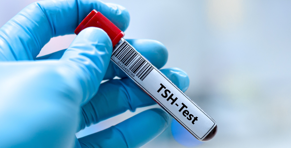 Analiză pentru tiroidă