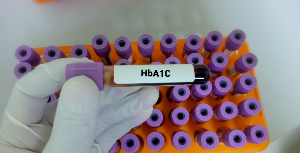 Analize de sânge pentru diabet