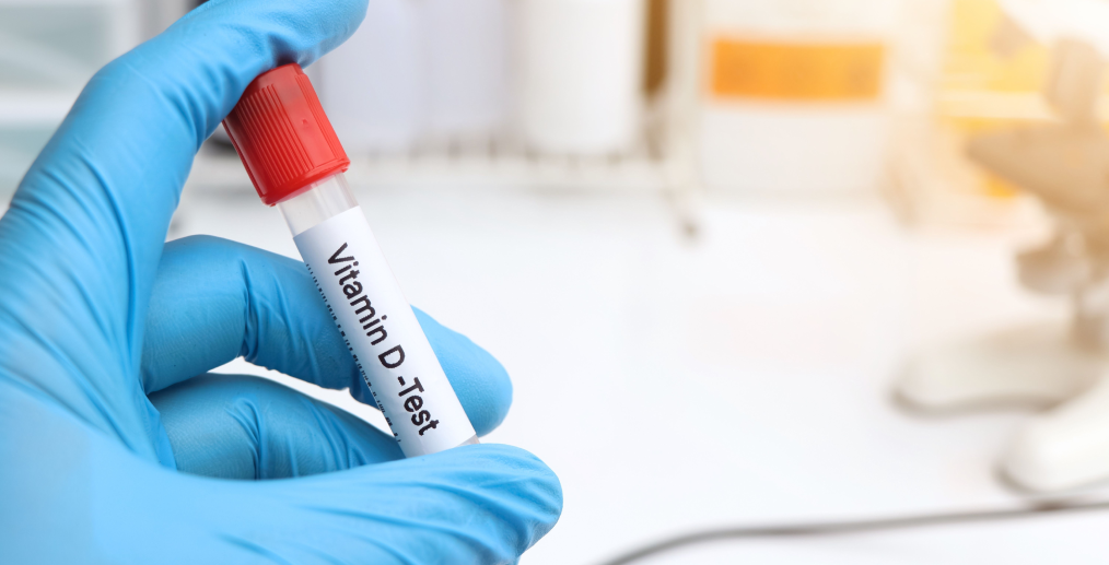 Analize vitamina D