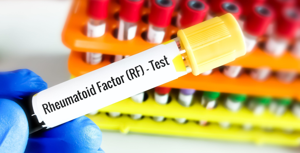 Factor reumatoid - FR
