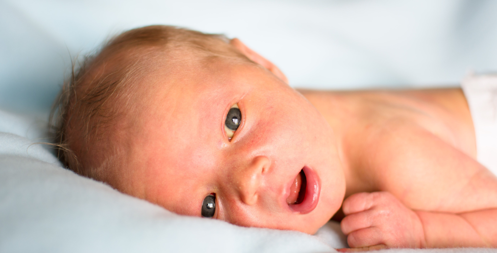 Icter la nou-născuți