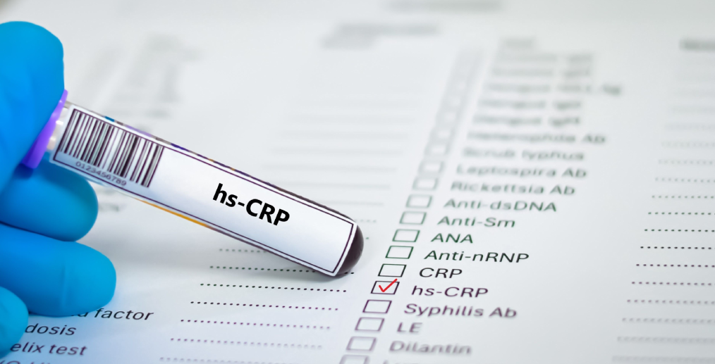 PCR ultrasensibil (hs-PCR)