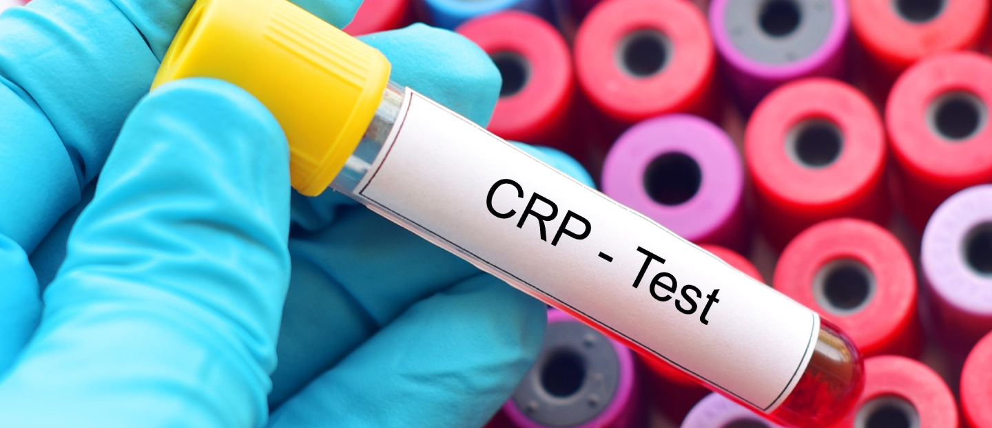 Markerii inflamatori: VSH și proteina C reactivă (PCR). Ce indică un nivel crescut?