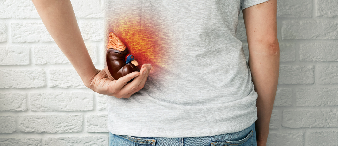 Ce este colica renală, de ce apare și cum se tratează