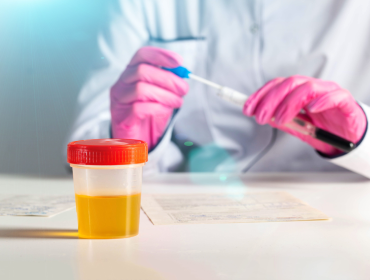 Analiză mucus în urină