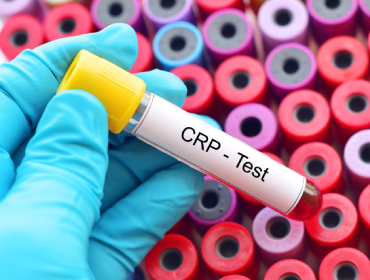 Analiză proteina C reactivă