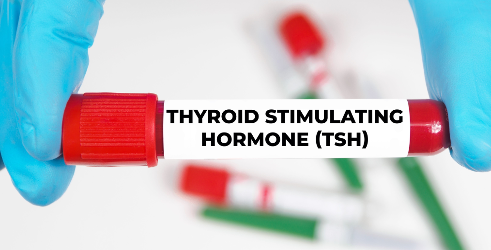 Analiza TSH