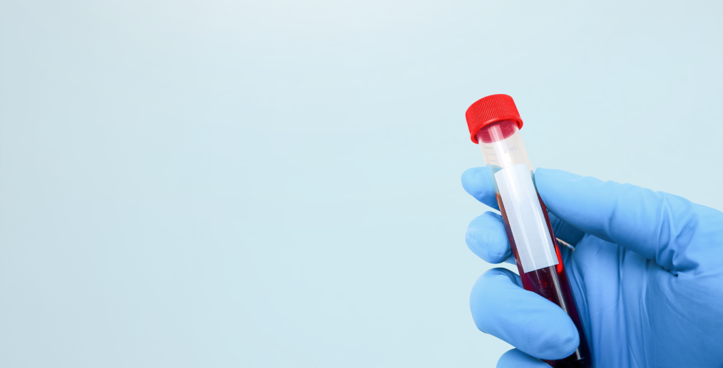 Analize de sânge pentru evaluarea funcției hepatice