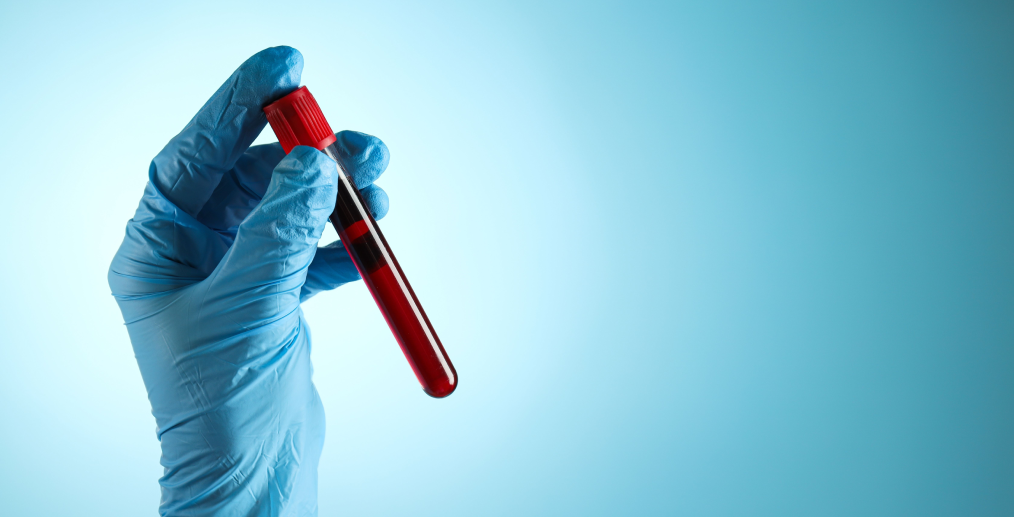 Analize de sânge pentru senzația de arsură pe limbă