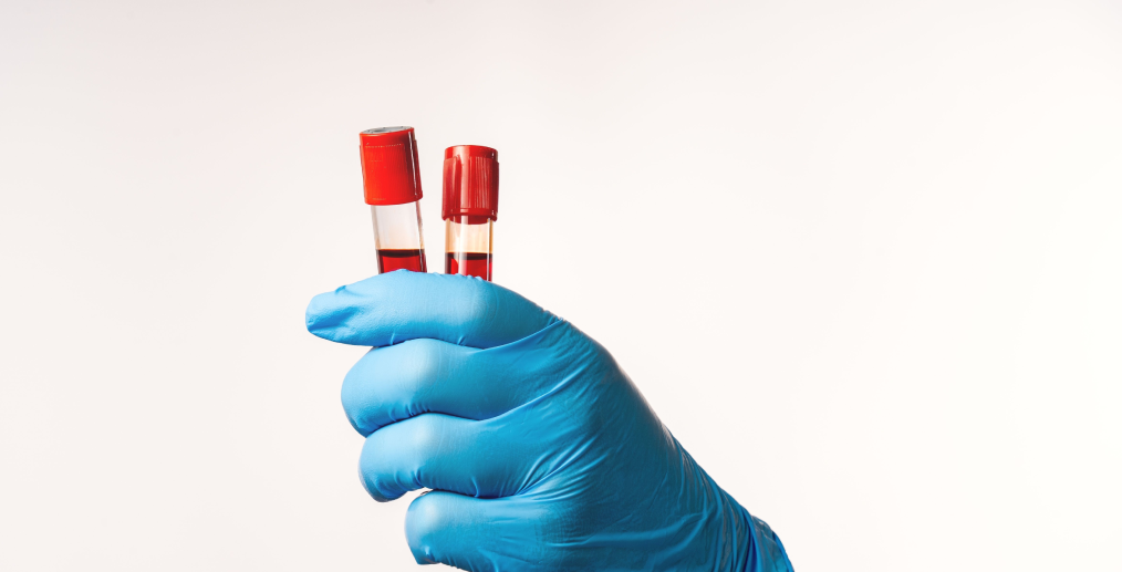 Analize pentru diagnosticarea cauzei vărsăturilor cu sânge