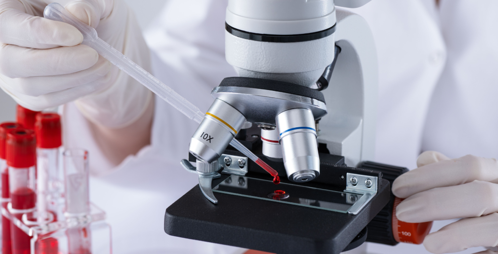 Examinarea probelor de sânge