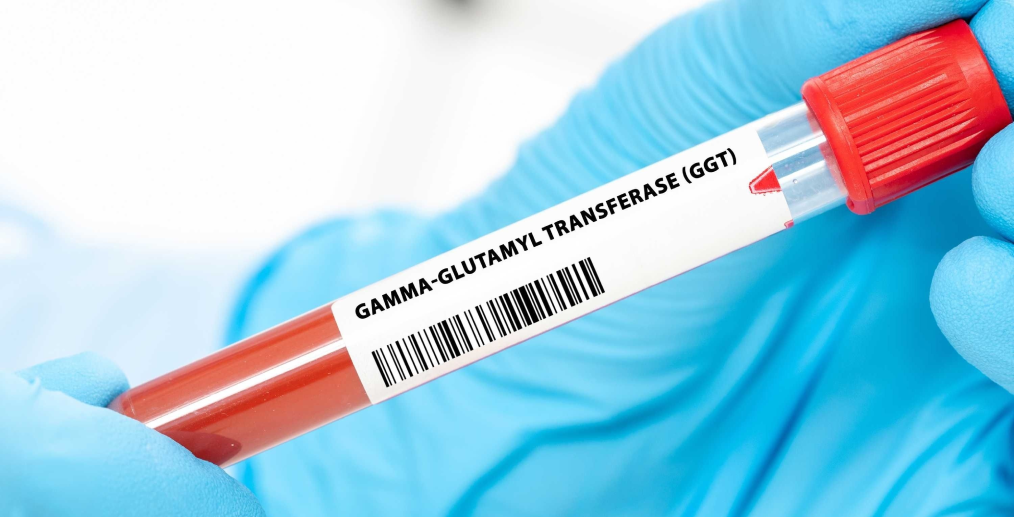 Gama-glutamiltransferaza