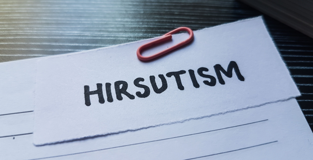 Hirsutismul este provocat de producția excesivă de hormoni masculini