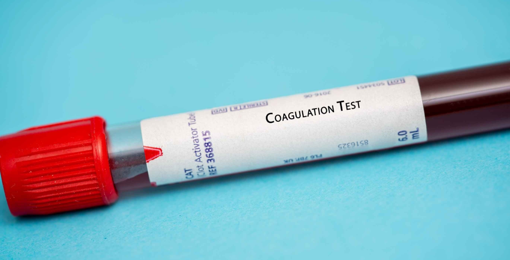 Teste de coagulare