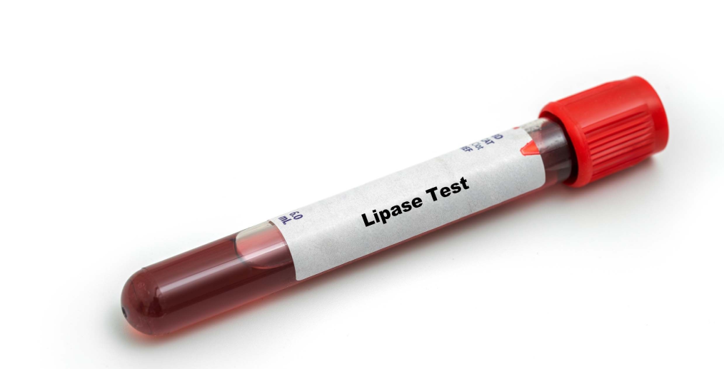 test lipaza