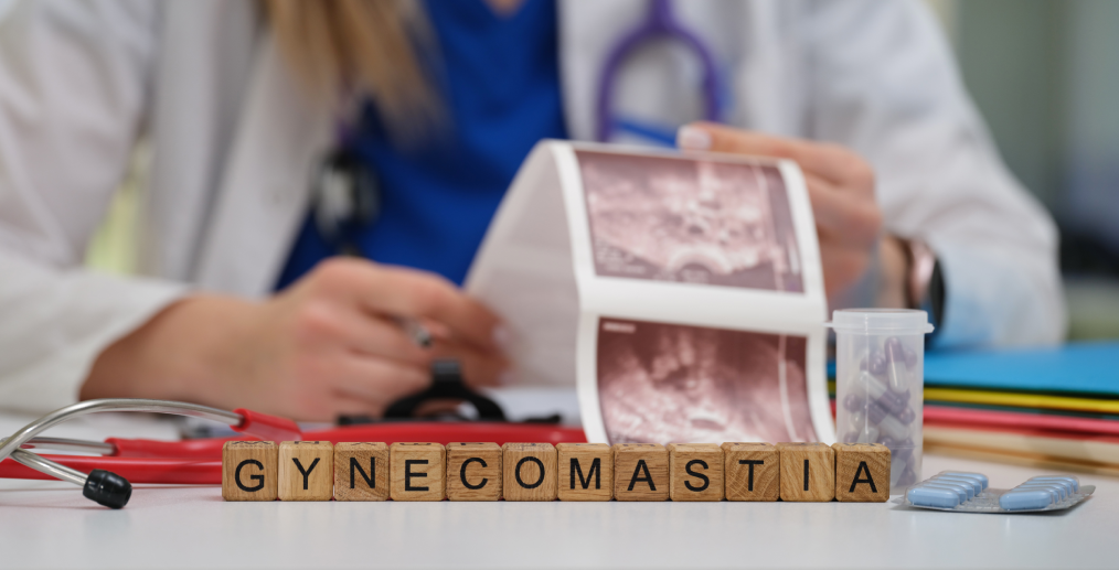 Administrarea de steroizi anabolizanți poate cauza ginecomastie