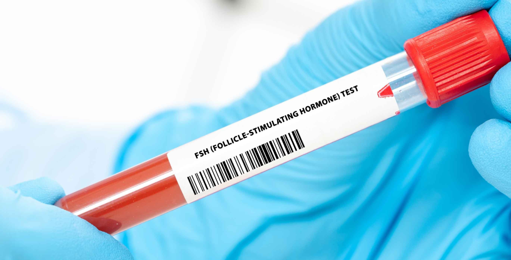 Analiza FSH oferă informații despre rezerva ovariană