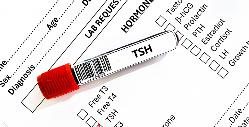 Analiza TSH