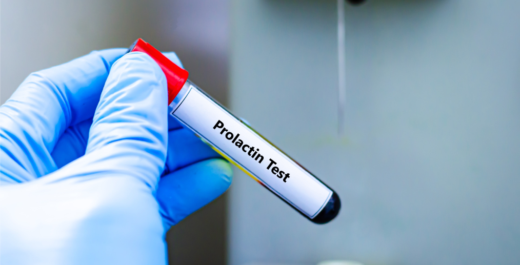Analiză de prolactină