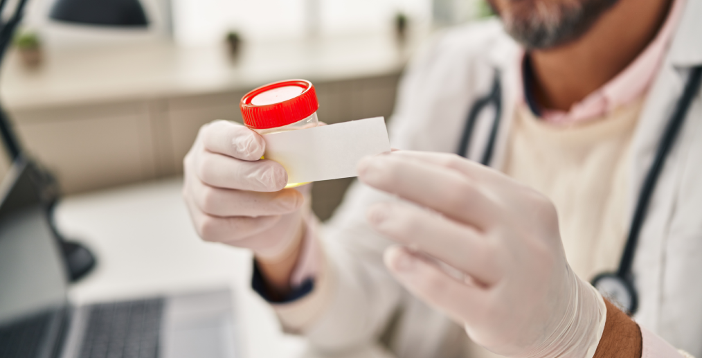 Analiză de urină pentru boli cu transmitere sexuală