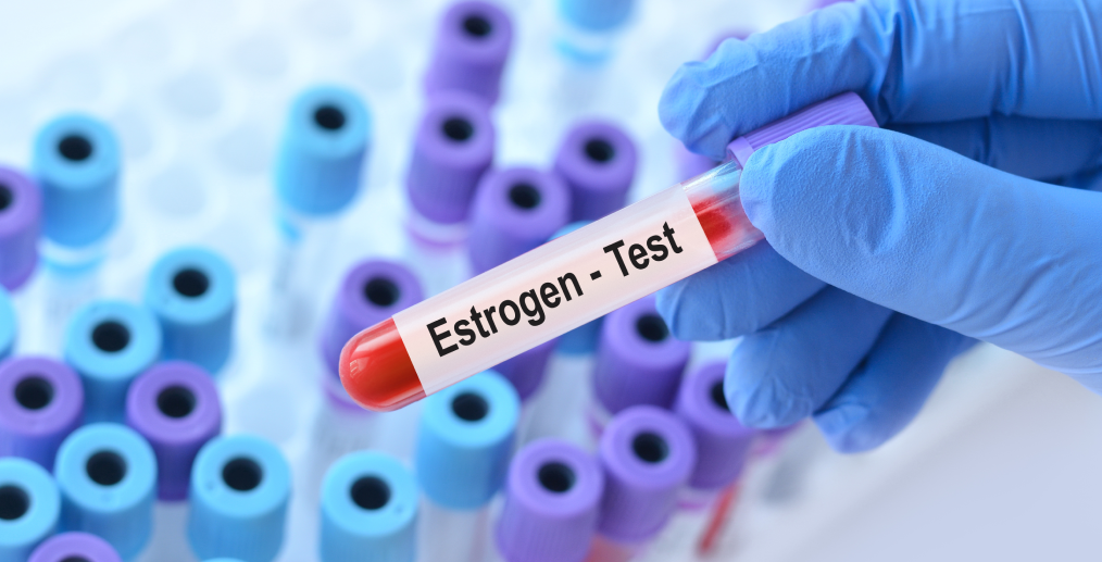 Analiză pentru măsurarea nivelului de estrogen