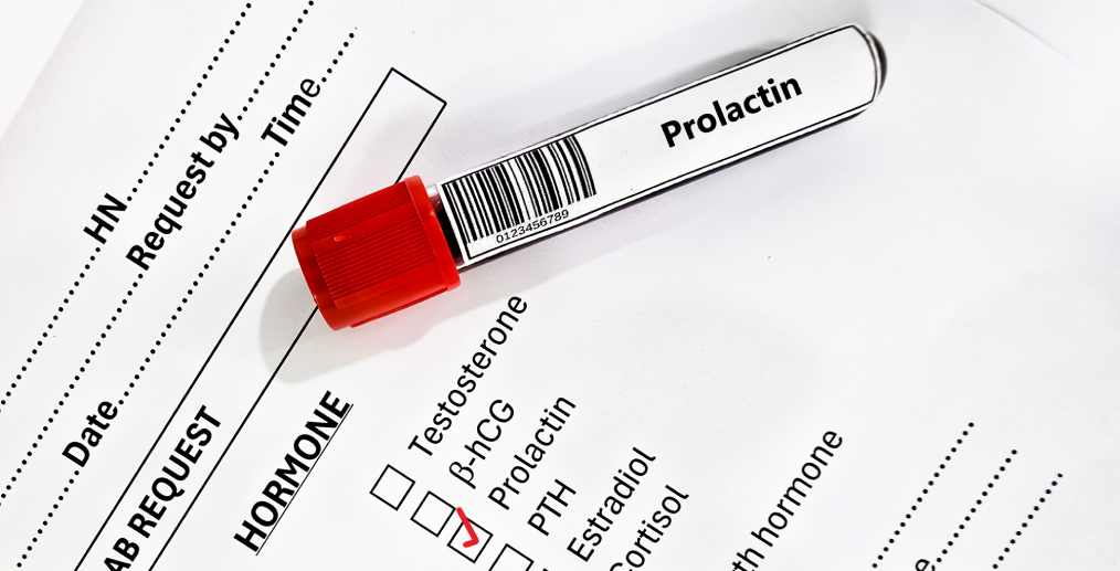 Analiză pentru măsurarea nivelului de prolactină