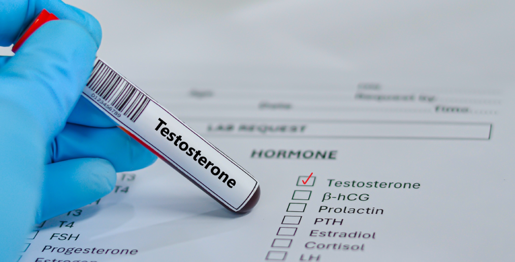 Analiză pentru măsurarea nivelului de testosteron