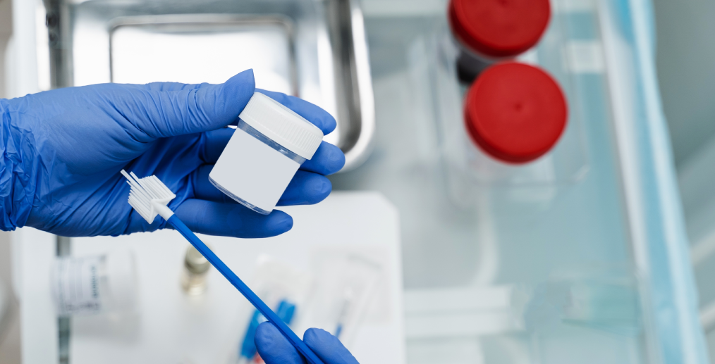 Examenul Babeș-Papanicolau